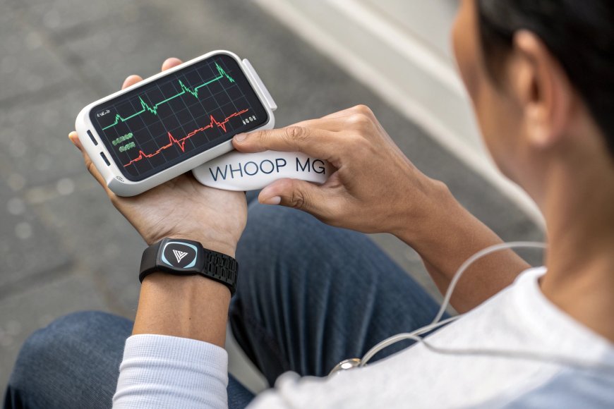 WHOOP 5.0 and MG: Redefining Health Tech with Blood Pressure, ECG, and 14-Day Battery Power
